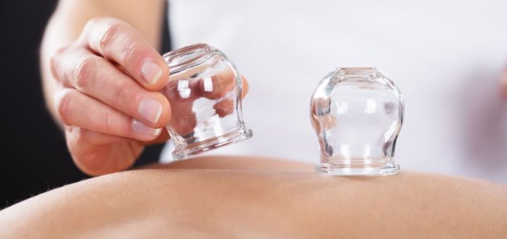 What You Should Know About the Ancient Art of Cupping